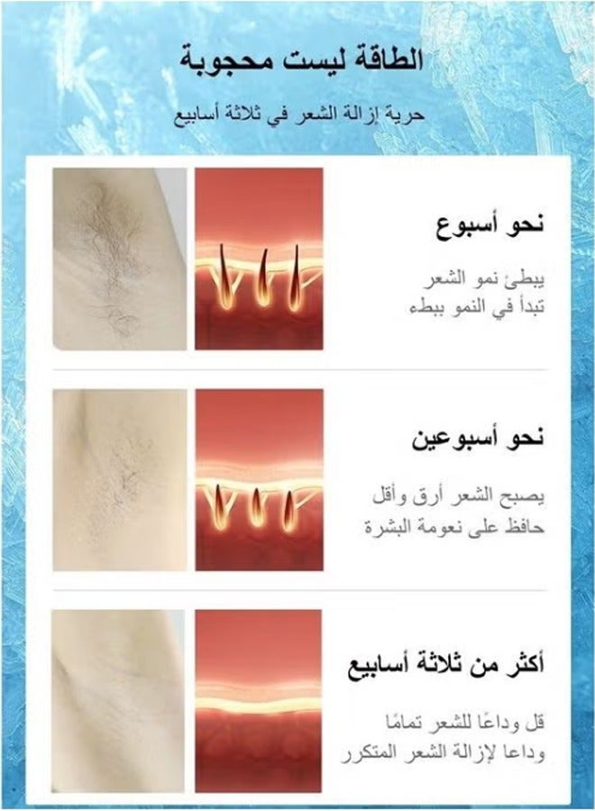 MLAY T14 Laser Painless Fast Hair Removal 3℃ Cold Compress/5-Levels/500000 Pulses Carry An Additional Lamp And Gift Sky Blue - Image 5