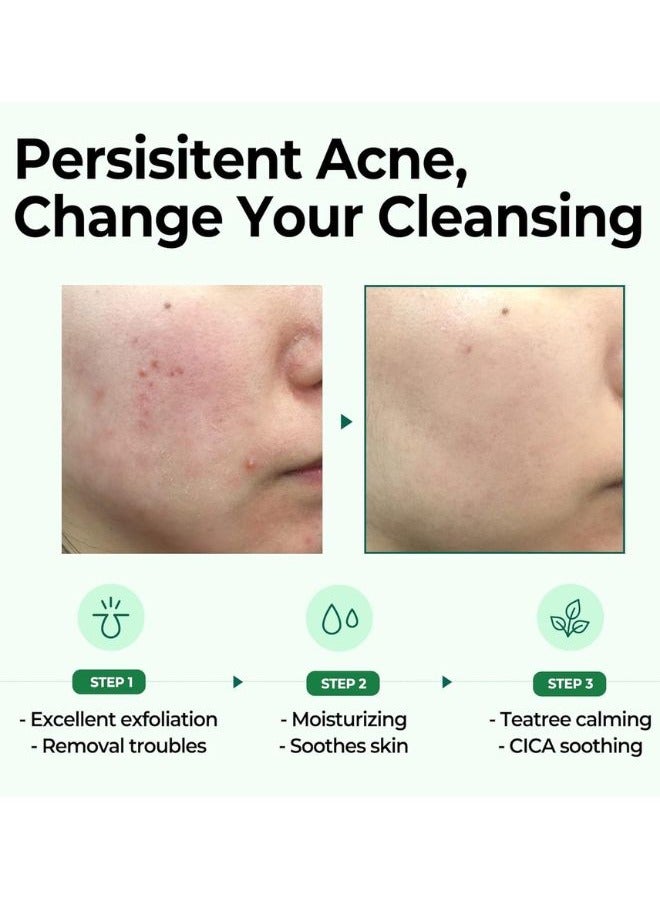 سام باي مي AHA-BHA-PHA 30 Days Miracle Cleansing Bar 106grams - Image 3
