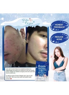 Gluta Frozen Frozen Collagen 2in1whitening 10X  Premium Collagen Peptide30000 Mg L-Glutathione 10000 Mg 60 Capsule  - Image 5