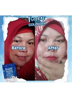 Gluta Frozen Frozen Collagen 2in1whitening 10X  Premium Collagen Peptide30000 Mg L-Glutathione 10000 Mg 60 Capsule  - Image 4