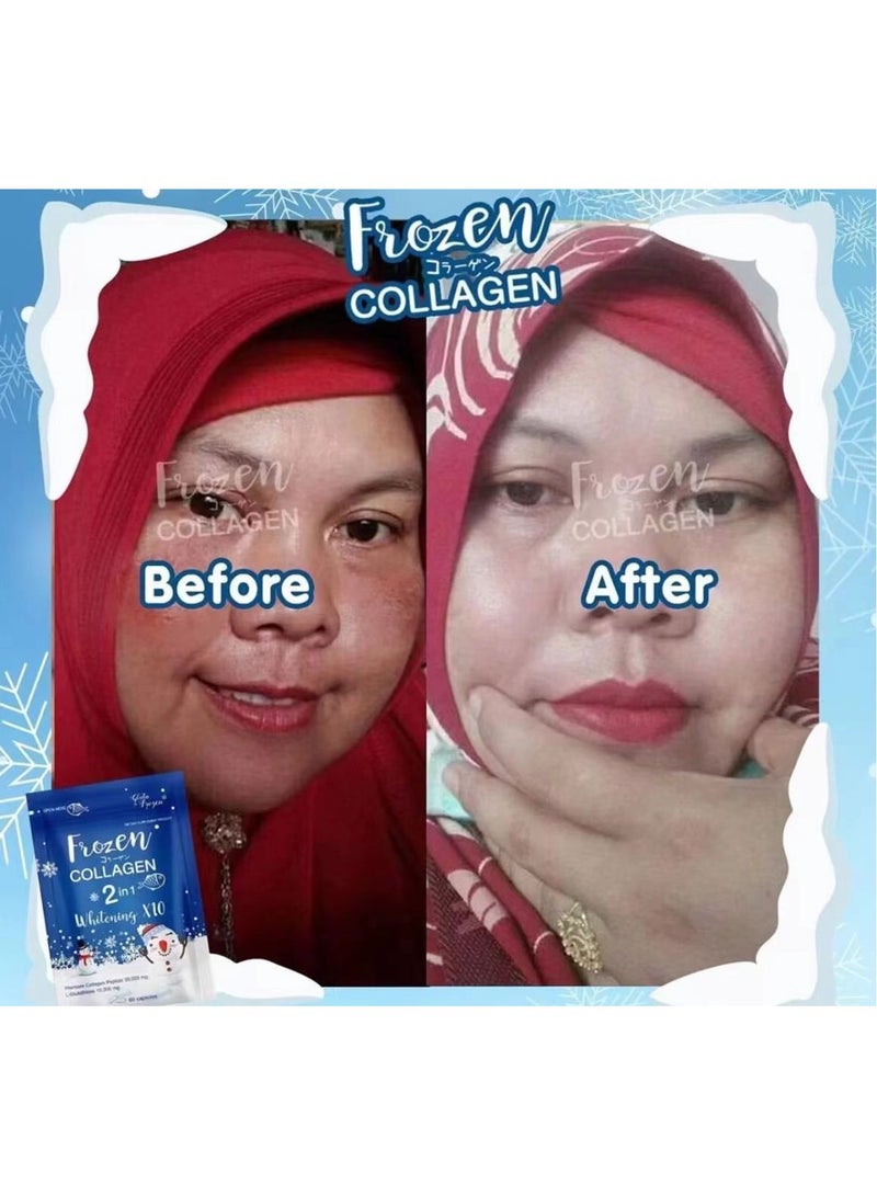 Gluta Frozen Frozen Collagen 2in1whitening 10X  Premium Collagen Peptide30000 Mg L-Glutathione 10000 Mg 60 Capsule  - Image 4
