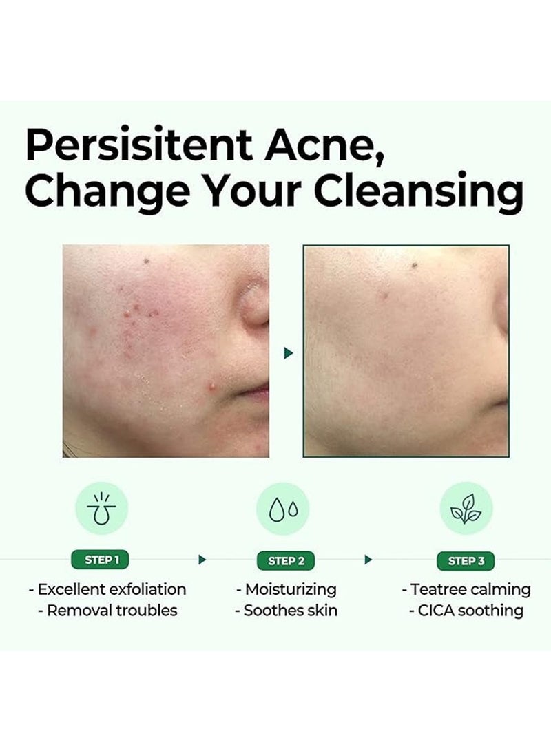 Some by Mi Aha-Bha-Pha 30Days Miracle Cleansing Bar - For Skin Exfoliating - Pore And Sebum Care - Improving Skin Tone - Inflammation 160grams - Image 3