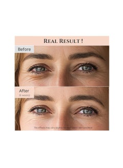 Beauty of Joseon 2 Piece Revive Eye Serum : Ginseng + Retinal Pink 30mlml  - Image 4