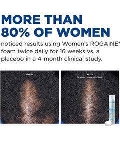 Rogaine 5% Minoxidil Foam, Topical Once-A-Day Hair Loss Treatment for Women to Regrow Fuller, Thicker Hair, Unscented, 2-Month Supply, 2.11 oz 60 gramsgrams  - Image 2