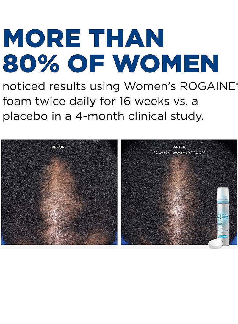 Rogaine 5% Minoxidil Foam, Topical Once-A-Day Hair Loss Treatment for Women to Regrow Fuller, Thicker Hair, Unscented, 2-Month Supply, 2.11 oz 60 gramsgrams - Image 2
