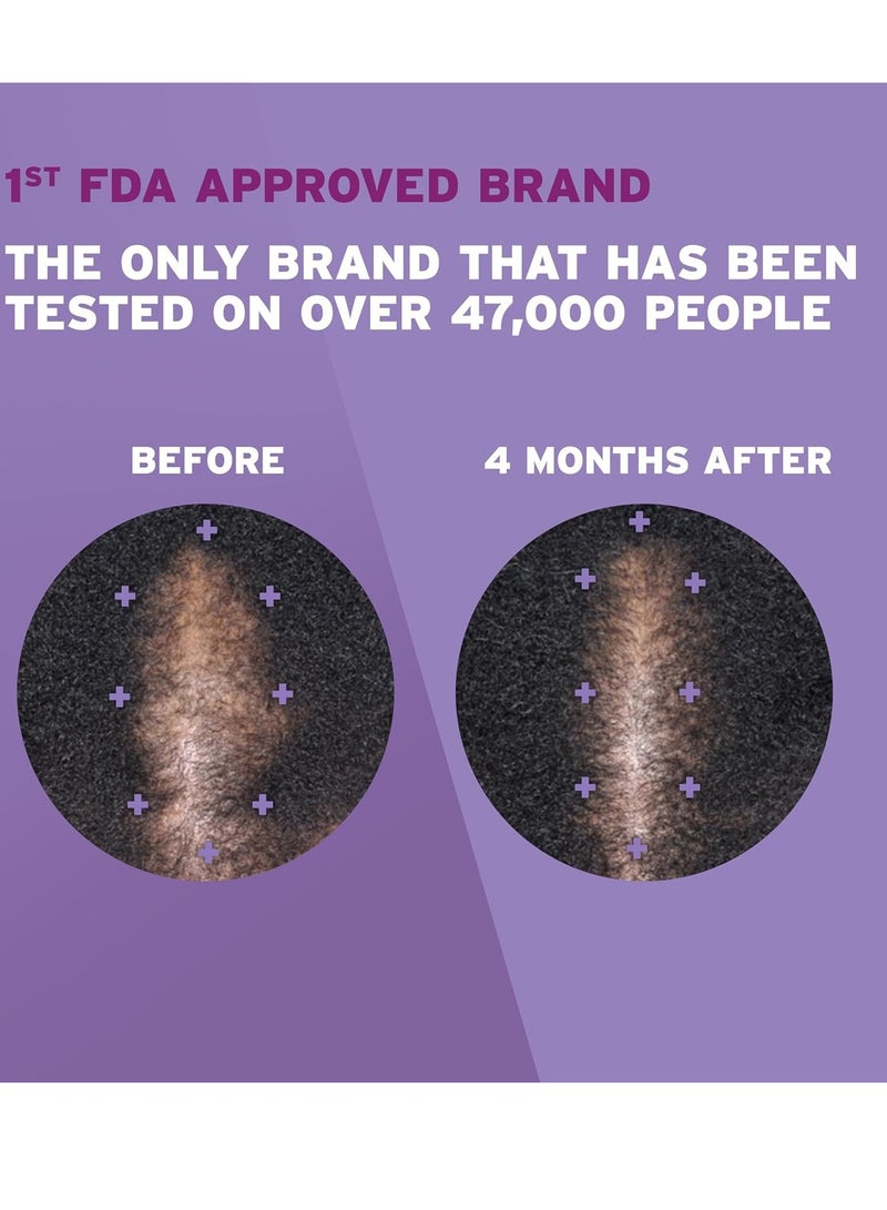 Rogaine 5% Minoxidil Foam, Topical Once-A-Day Hair Loss Treatment for Women to Regrow Fuller, Thicker Hair, Unscented, 2-Month Supply, 2.11 oz 60 gramsgrams - Image 4