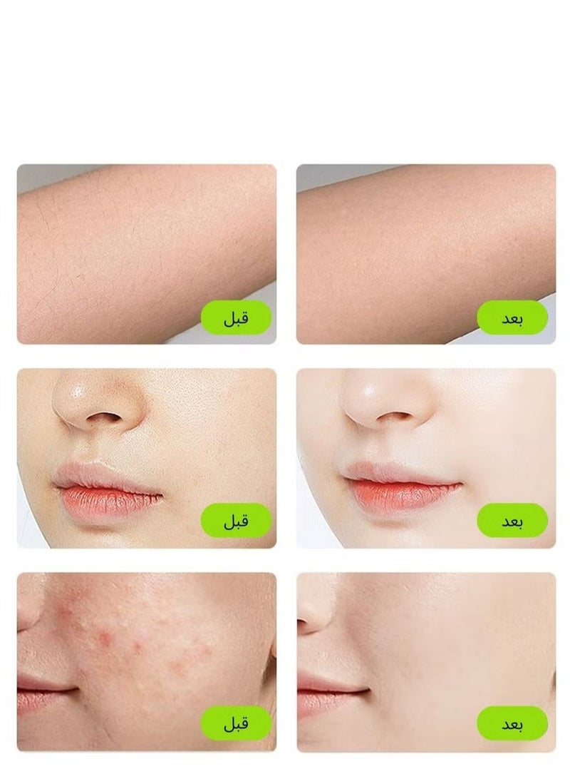 T14 5 in 1 IPL Hair Removal Device, 3℃ Ice Cooling Laser Hair Removal, 500,000 Flashes 0.5s/Flash Painless Hair Removal Device Remove Acne/Skin Rejuvenation for Whole Body Bikini Face Arm Armpit Back Leg - pnsku/N70137733V/45/_/1735285705/19bf6755-214f-4a92-8fbf-c27afdea5212
