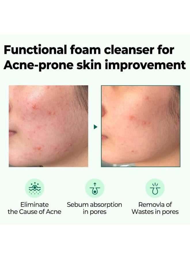 Some by Mi AHA-BHA-PHA 30 Days Miracle Acne Clear Foam 100ml - Image 3