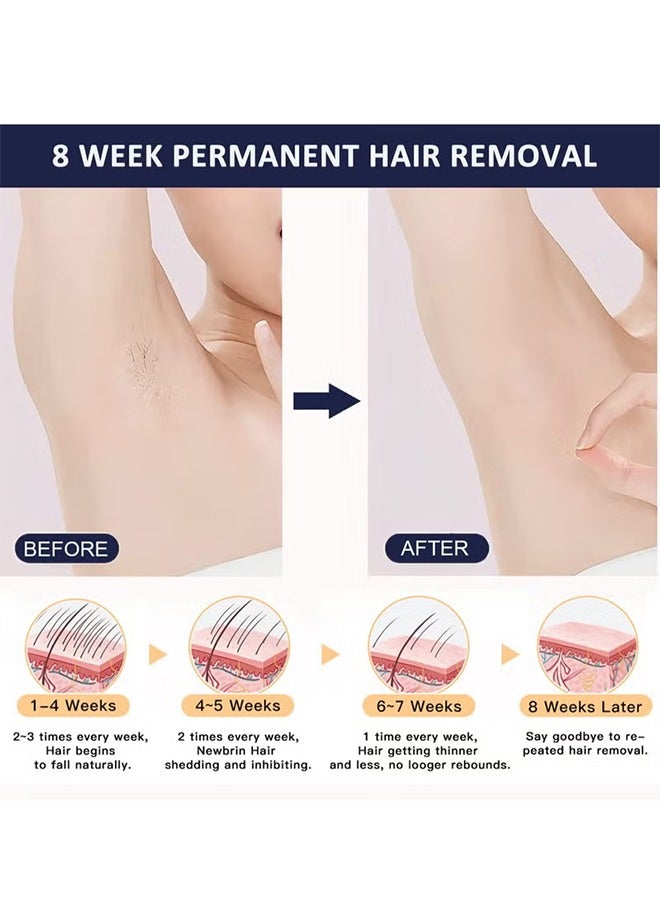 MLAY T14 Painless Ice Compress Laser Hair Removal Device,500,000 Flashes Epilator For Whole Body Bikini Line Arm Armpit Face Back Leg (1*HR Lamp) Dark Blue - Image 5