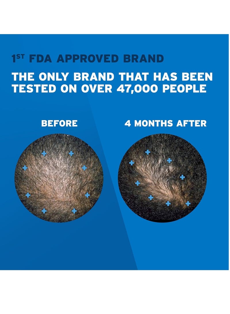 Rogaine Men's Rogaine 5% Minoxidil Foam for Hair Loss and Hair Regrowth, Topical Treatment for Thinning Hair, 3-Month Supply 2.11 Ounce, 3 Countounce - Image 3