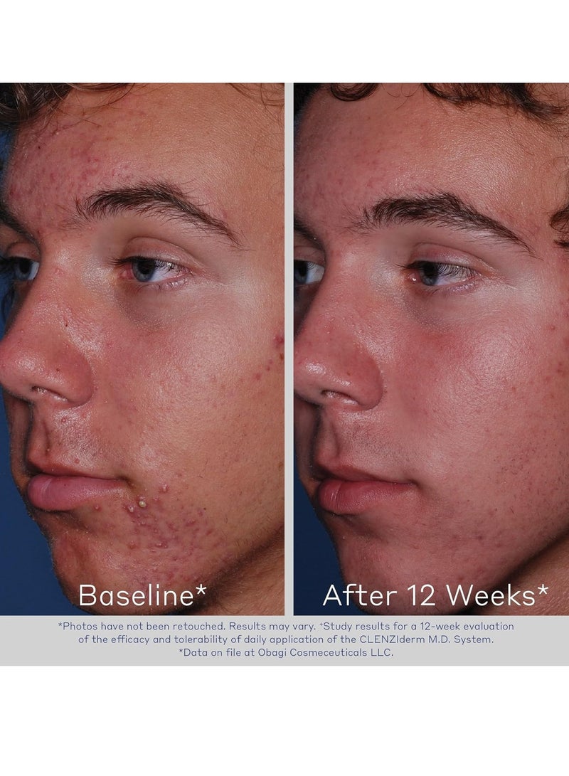 أوباجي منظف حب الشباب الرغوي للعناية اليومية من CLENZIderm M.D. – علاج حب الشباب مع 2% حمض الساليسيليك (BHA) - Image 3
