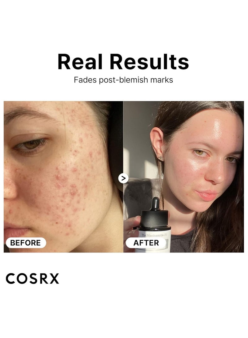 Cosrx Niacinamide 15% Face Serum, Minimizing Pores & Sebums, Blemish Treatments for Discoloration, Dark Spots, Enlarged Pores, Anti-aging, 0.67 fl.oz / 20 ml, Animal Testing-Free o.2cm  - Image 2