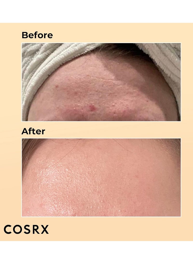 مستخلص قوة المخاط المتقدم 96 من الحلزون، سيروم المخاط الحلزوني الكوري ومرطب الوجه للترطيب العميق، إصلاح البشرة وإشراقة البشرة مع 96% من فلتر إفراز الحلزون، العناية بالبشرة الكورية - Image 2