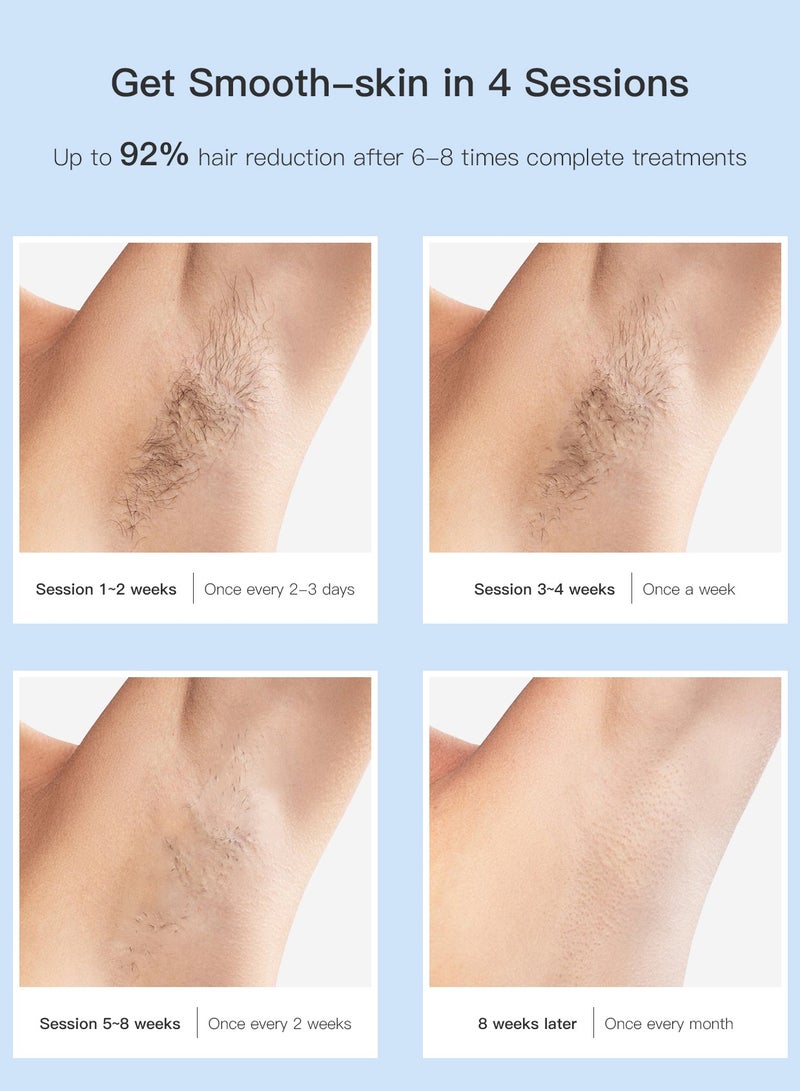 MLAY T4 Laser Hair Removal Device with Ice Cooling, 5 Energy Levels, 500,000 Flashes, Auto And Manual Modes for Face, Legs, Bikini And Full Body blue - Image 3