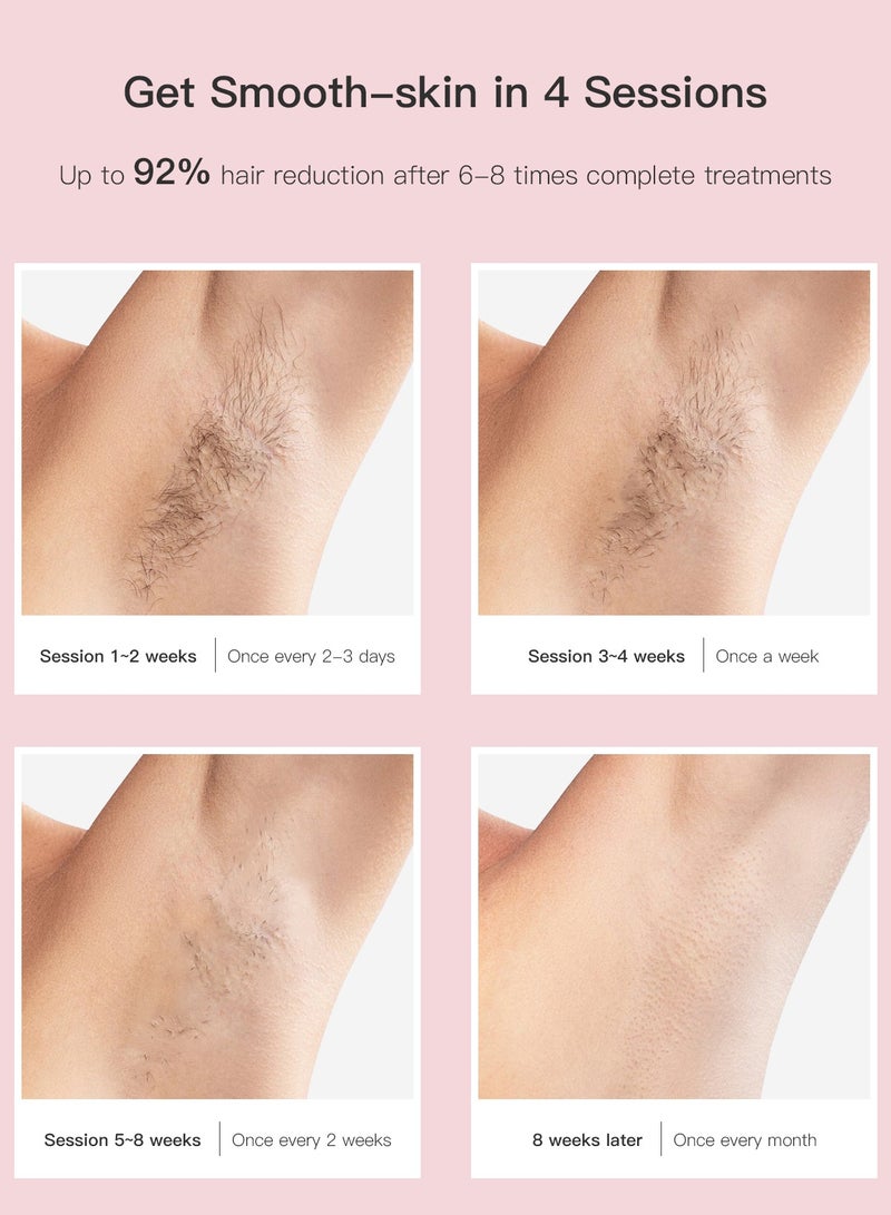 MLAY T4 Laser Hair Removal Device with Ice Cooling, 5 Energy Levels, 500,000 Flashes, Auto And Manual Modes For Face, Legs, Bikini And Full Body pink  - Image 3