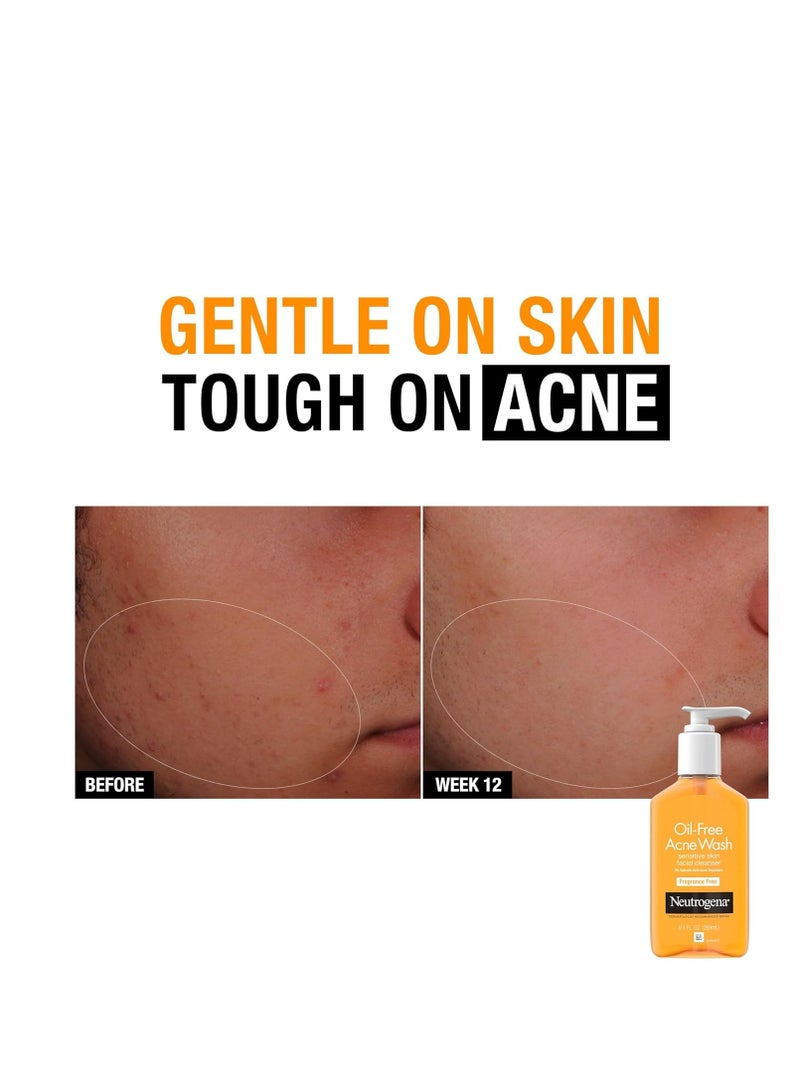 Neutrogena Oil-Free Acne Face Wash, Sensitive Skin Facial Cleanser with 2% Salicylic Acid Acne Treatment, Daily Fragrance Free Face Wash for Acne Prone Skin 9.1 fl ozFluid Ounce - Image 5