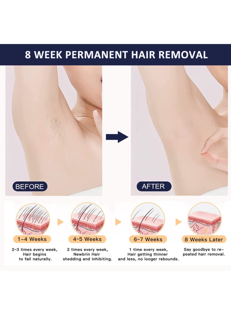 MLAY T14 IPL Laser Painless Fast Hair Removal  Removal Device 3℃ Cold Compress/5-Levels/500000 Pulses Carry An Additional Bikini Lamp And Face Lamp Dark Blue Dark Blue - Image 5