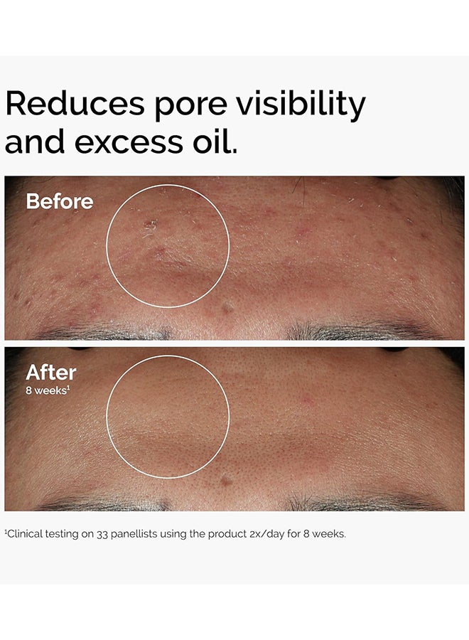 The Ordinary Niacinamide 10% + Zinc 1% - 30ml - Image 5