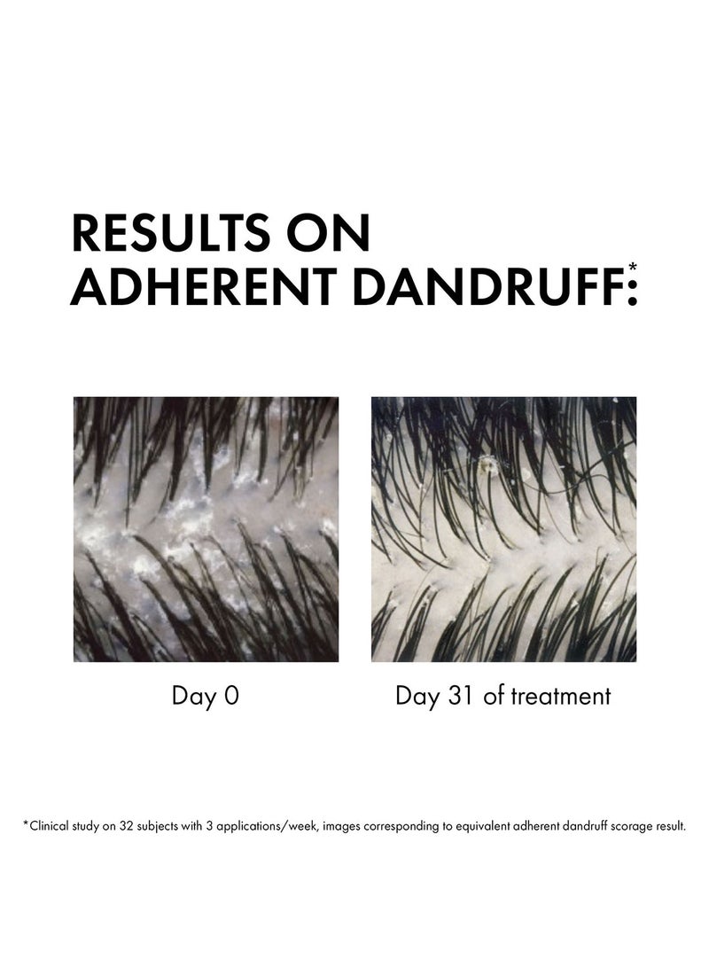 فيشي Dercos Anti-Dandruff Shampoo Dry Refill 390ml - Image 3