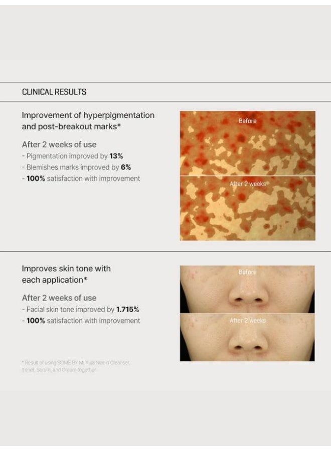 سام باي مي كريم SOME BY MI يويا نياكين لمكافحة العيوب 60 مل (2.02 أونصة) – مرطب جل مضيء بفيتامين C + نياكيناميد للبقع الداكنة، علامات حب الشباب وتفاوت اللون | كريم وجه كوري خفيف الوزن مرطب مع مستخلص اليوزا (يويا) للتألق، العناية بالمسام وبشرة ناعمة وواضحة – كريم يومي لتفتيح البقع. - Image 5