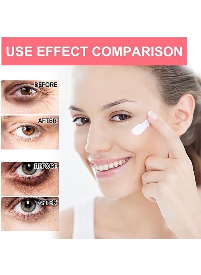 إيلهو الريتينول كريم العين العصي ، وإصلاح الجلد العين الخطوط الدقيقة ، العطاء ، على نحو سلس مرطب العين الرعاية كريم العين ، وإصلاح شركة ، واستعادة حيوية العين ، والحد من الخطوط الدقيقة والتجاعيد - Image 5