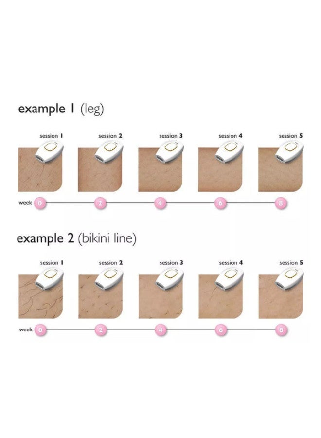 IPL Hair remover device for hair removal using laser technology - Image 3