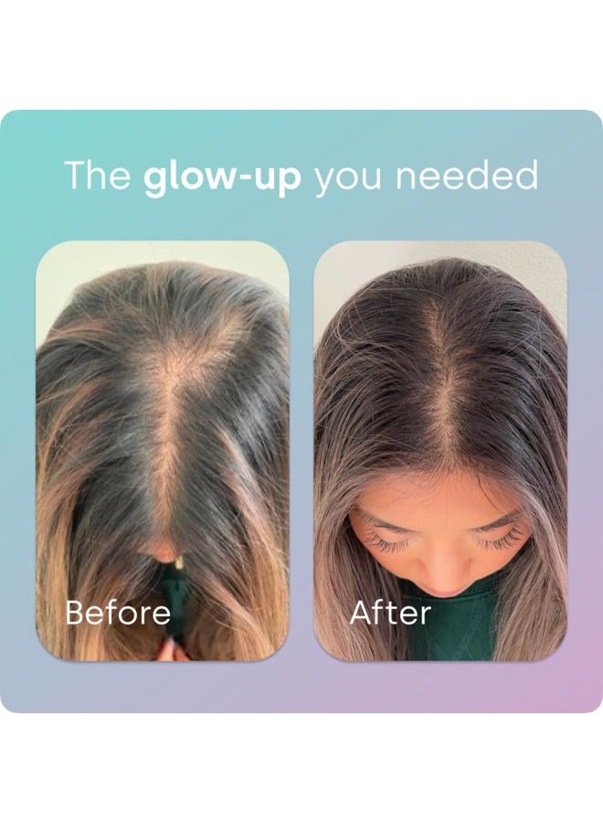 BIOSIL Advanced Hair + Nail Care - 60 Capsules - Grow, Strengthen & Thicken Hair and Nails - with Patented ch-OSA & Biotin - 60 Servings - Image 3