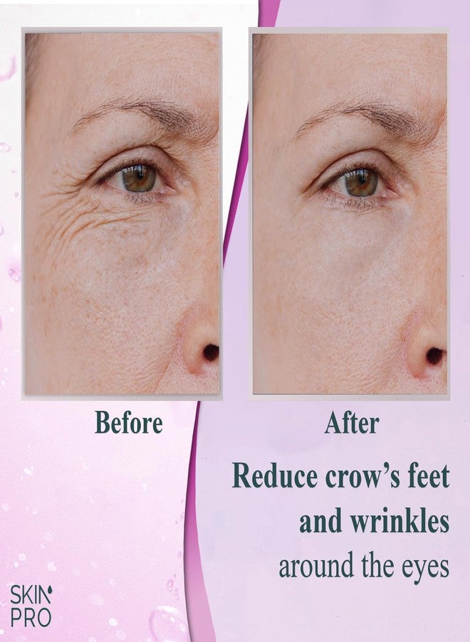 SkinPro سيروم سكين برو إلت 10 - سيروم طبيعي لمكافحة الشيخوخة حول العين وعلاج التجاعيد - مزيل لانتفاخات العين والهالات السوداء مع تركيبة متقدمة من حمض الهيالورونيك والكولاجين والأرجيريلين والبيبتيدات - Image 3