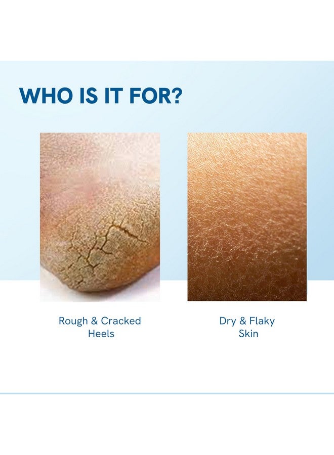 Be Bodywise Dry Skin & Heel Repair Kit | Deeply Hydrates & Exfoliates Skin | Infused with Ceramides | 20% Urea Foot Roll On (50ml) + 10% Urea Body Lotion (200ml) - Image 5