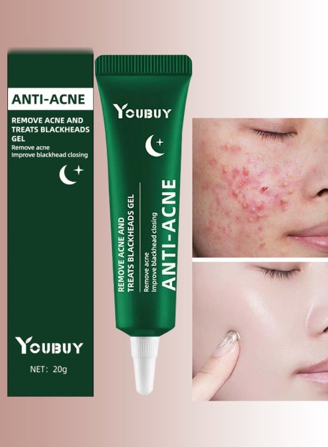 YOUBUY Anti Acne Remove Acne and Treats Blackheads Gel for Night Use Remove Acne Pimple and Treats Blackhead with Salicylic Acid Oil Control Shrink Pores Redness Relief Skin Lightening Scar Fade Cream Acne Remover Cream 20g - Image 1