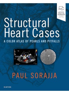 Structural Heart Cases: A Color Atlas of Pearls and Pitfalls