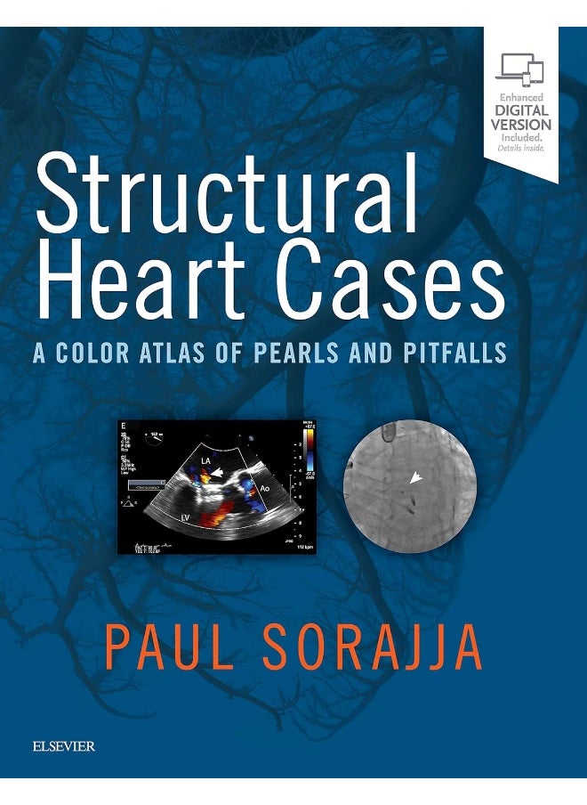 null - Structural Heart Cases: A Color Atlas of Pearls and Pitfalls - Image 1