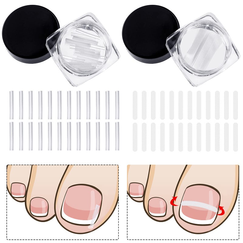 Maitys 60 Pieces Ingrown Toenail Corrector Strips Ingrown Toe Nail Correction Brace Correction Clip Toe Nail Straightening Recover Patch Curved Toenail Corrector for Women Men Foot Care, 2 Styles - Image 1