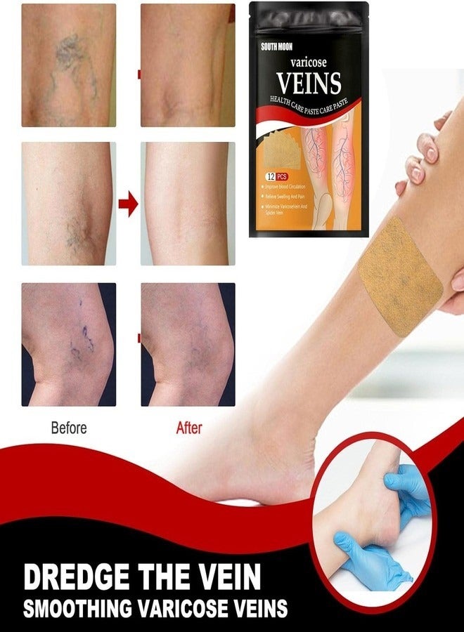 SOUTH MOON Varicose Vein Patch - 12 Pcs Vein Health Patch,Varicose Vein Patch for Vein Health, blood circulation, Swelling, Vein Health Patch for Relief Leg  - Image 2