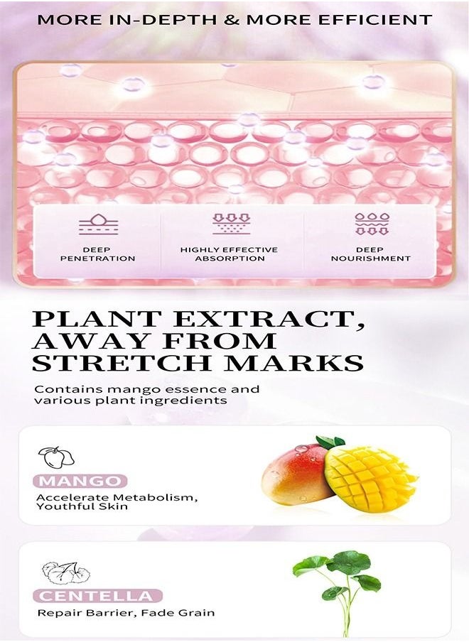 Mango Stretch Mark Cream for Fade Line Moisturizing, Contains Mango Essence, Can Promote Cell Regeneration, Repair Necrotic Cells and Enhance Skin Elasticity, Designed for Mother's Stretch Marks