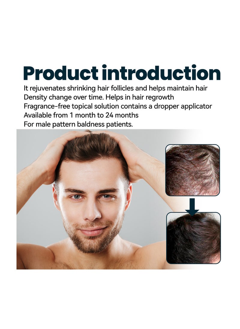 Kirkland Signature - 3-Pcs Minoxidil 5% Extra Strength Hair Regrowth Treatment for Promote Men's Hair Growth,Prevent Hair Loss,Care for Hair - Image 1