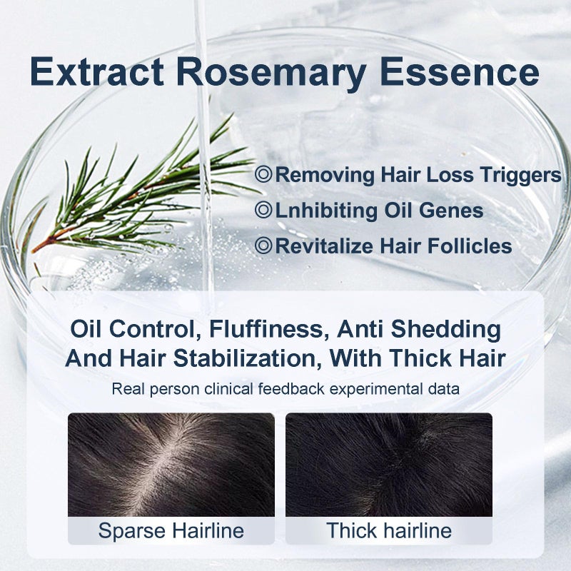 Tgideas Organic Biotin & Rosemary Hair Growth Shampoo â€“ Thickening Shampoo with Amino Acids for Hair Loss, Dandruff Control & Oily Scalp - for Women & Men - Image 3