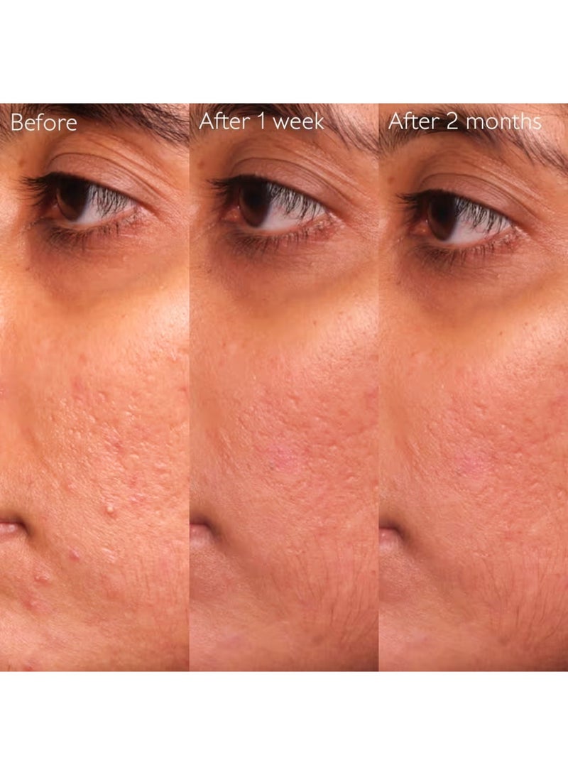 CAUDALIE سيروم فينوبور للتحكم في العيوب - 30 مل - Image 5
