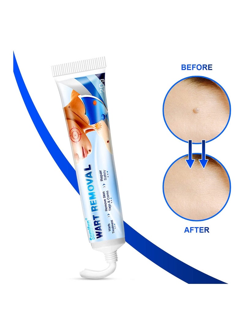 سوميفون كريم مرهم لإزالة الثآليل ، ثؤلول شائع لإزالة علامات بشرة الجسم ومزيل علامات بشرة الوجه - Image 2