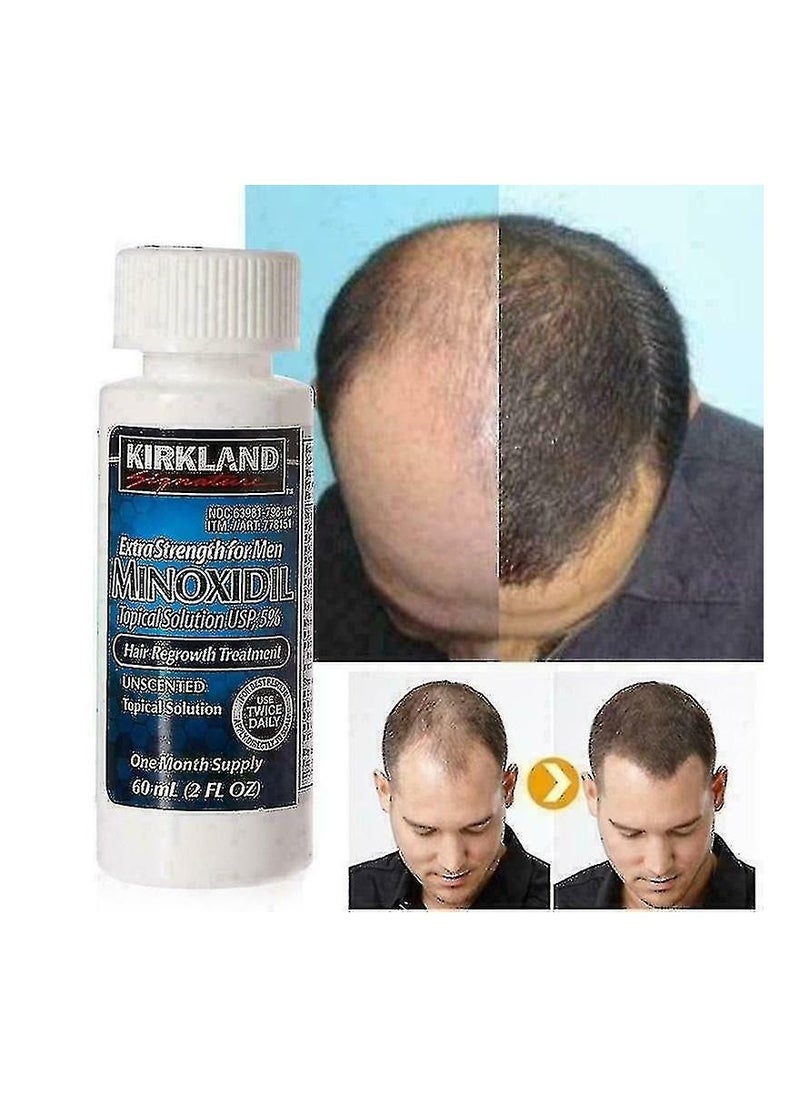 Kirkland Signature - Kirkland Minoxidil 5% 3 Bottles Liquid – 3 Months Supply for Men 180ml - Image 1