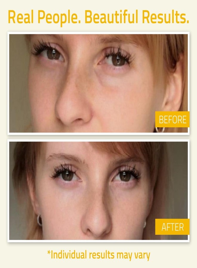 YEOUTH Under Eye Gel with Hyaluronic Acid for Puffiness, Under Eye Bags & Circles, Hydrating Skincare for Tired-Looking Eyes 1oz - Image 4