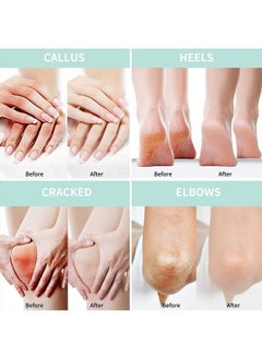 Foot Callus Remover for Feet Extra Strenght with Salicylic Acid