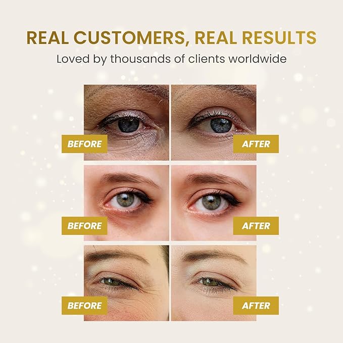 Plantifique Under Eye Gel Patches 20 Pairs Gold Under Eye Patches for Dark Circles with Collagen Caffeine Cooling Eye Mask for Puffy Eyes and Bags Gel Eye Pads Under Eye Masks Skincare - Image 4