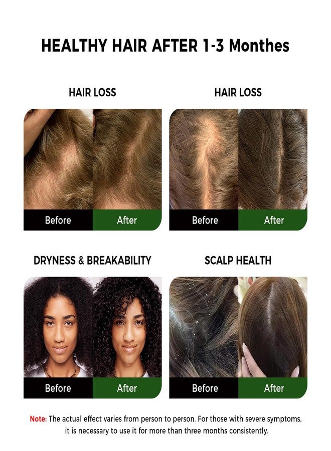 OUKEYA Batana Oil for Hair Growth: Dr Sebi Organic Raw Batana Oil from Honduras - 100% Pure & Natural Cold Pressed - For Thicker Stronger Hair - 4.05 OZ, Reduce Split Ends and Hair Loss in Men Women - Image 5