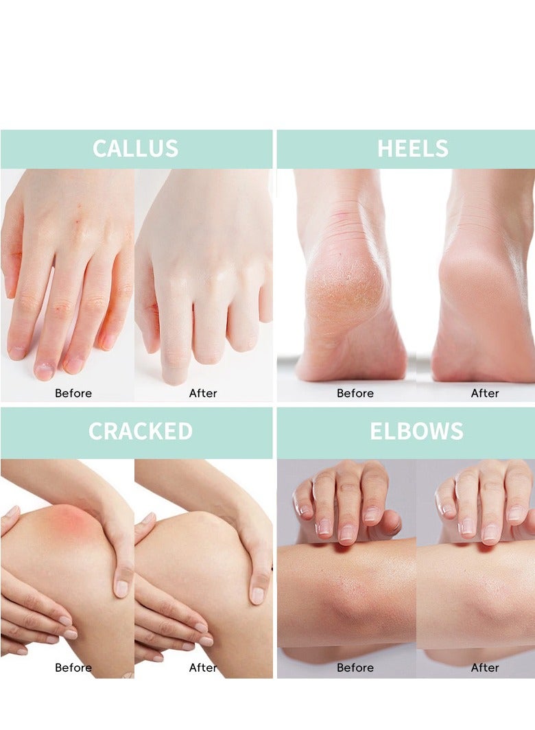 Fly Leaf Urea Cream 40 Percent for feet Plus 2% Salicylic Acid 5.29 oz || Maximum Strength for Dry ed Heels, Foot, Hands, Knees, Elbows Repair, and Deep Moisturizes, Callus Remover and Soften - Image 5