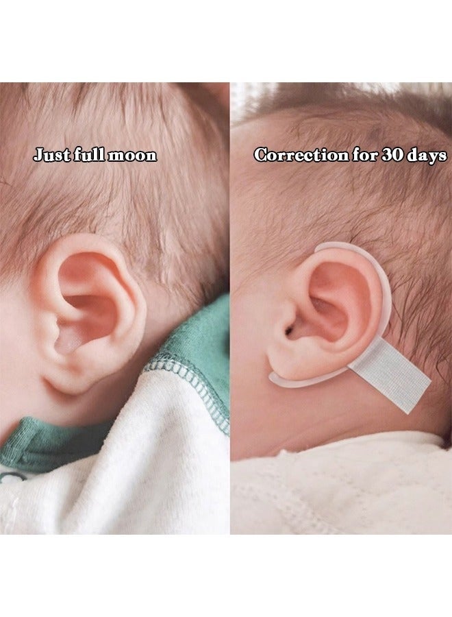 كيلا رقعة تصحيح انحراف الأذن للرضع، تصحيح أذن الأطفال، مصححات تجميل أذن حديثي الولادة، ملصقات بروز الأذن للرضع - Image 3