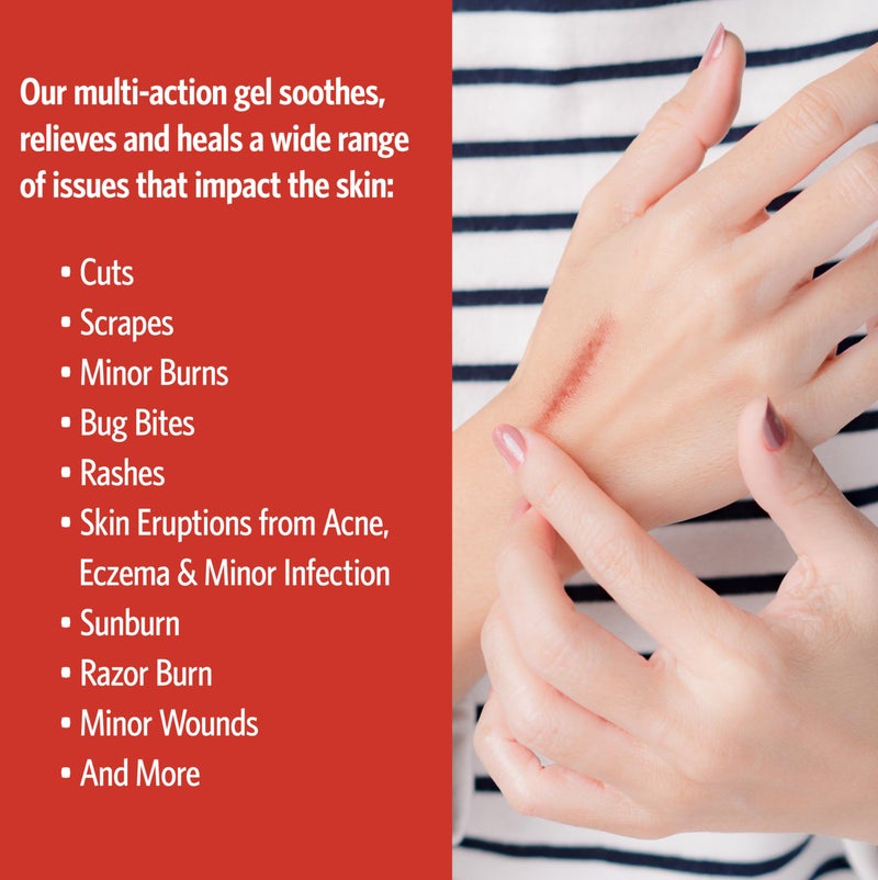 Sovereign Silver First Aid Gel – Topical Healing Homeopathic Medicine, 2 oz. - Image 5