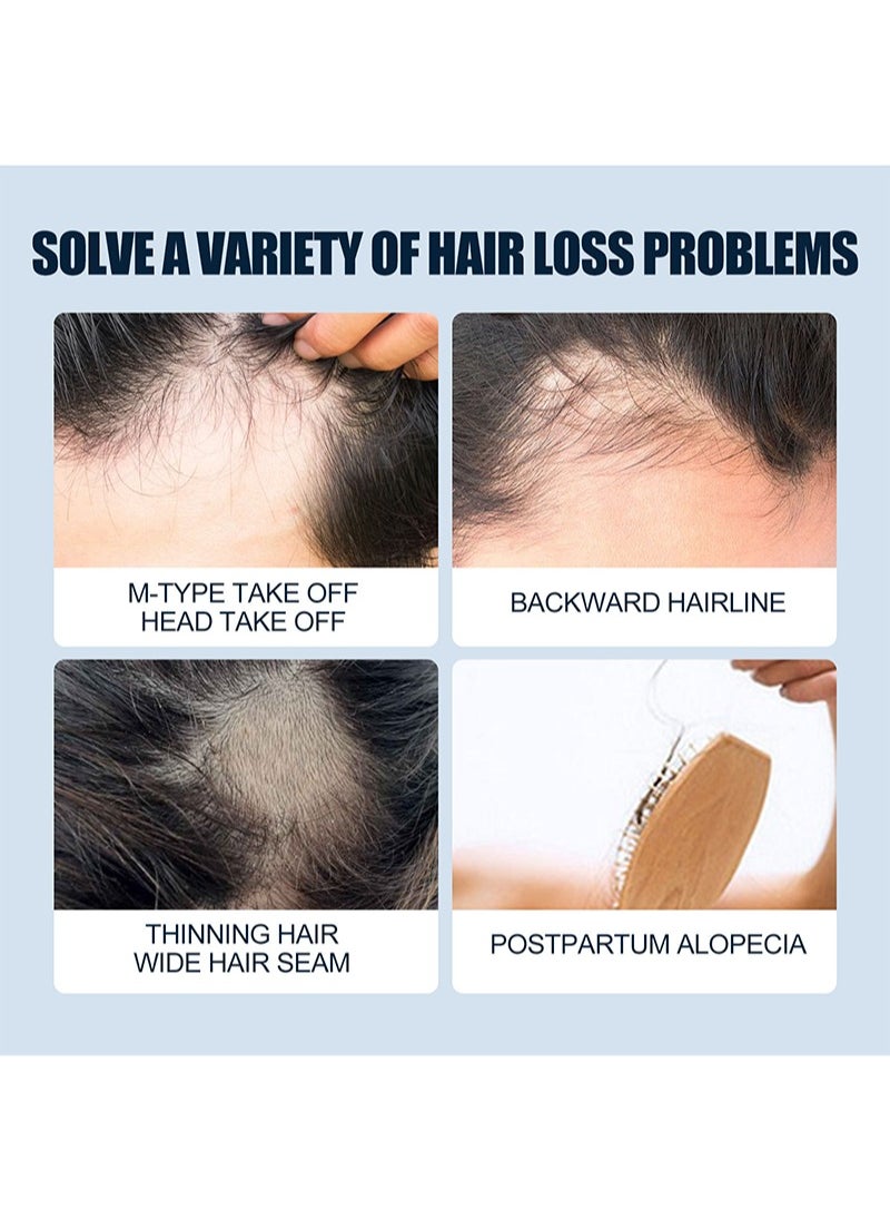 Men's Scalp Care Hair Regrowth Spray, Hair Regrowth Treatment, Re-activates Hair, Stimulates Hair Follicles, Reduces Hair Loss,For Men Damaged Hair Regrowth Hair Repair Spray 30ml