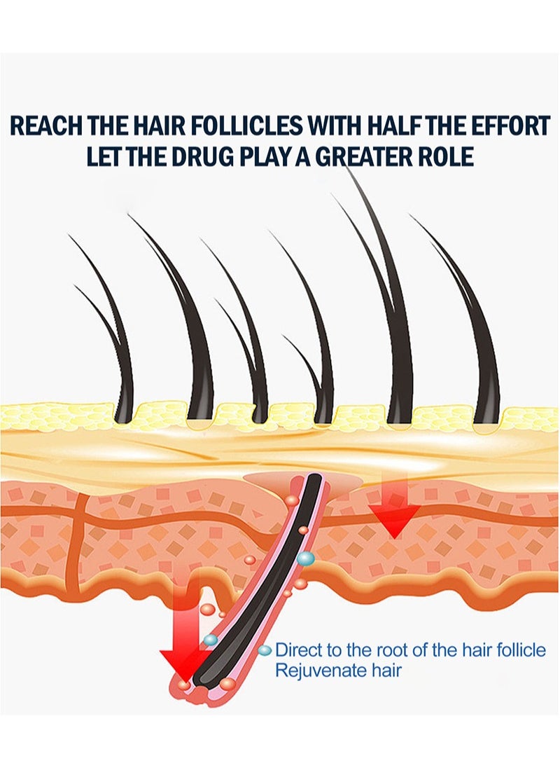 Men's Scalp Care Hair Regrowth Spray, Hair Regrowth Treatment, Re-activates Hair, Stimulates Hair Follicles, Reduces Hair Loss,For Men Damaged Hair Regrowth Hair Repair Spray 30ml