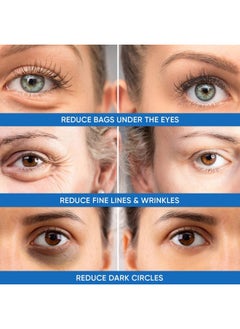 Dermlogic Under Eye Puffiness & Dark Circles Rapid Treatment- Instantly Reduces the Appearance of Puffy Eye Bags, Crow's Feet, & Sagging Skin.  - Image 3